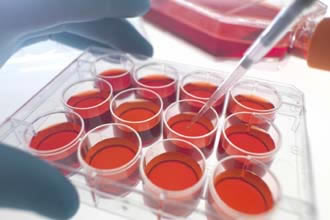 Cell-based assay is one of the cutting edge life sciences.